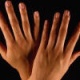 Οι μολύνσεις από μύκητες στα νύχια των χεριών και των ποδιών: Σημεία, συμπτώματα, θεραπεία και πρόληψη