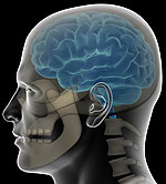 Ο εγκέφαλος μπορεί να πάθει βλάβες μετά από οποιοδήποτε ατύχημα με κτύπημα στην κεφαλή.