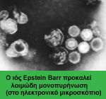Λοιμώδης μονοπυρήνωση, νόσος του φιλιού: Ο ιός του Epstein Barr, που προκαλεί τη λοιμώδη μονοπυρήνωση, σε φωτογραφίες που λήφθηκαν με ηλεκτρονικό μικροσκόπιο.