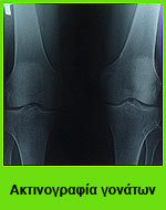 Για τους πόνους στα γόνατα είναι πολύ σημαντικό να γίνεται η ορθή διάγνωση της αιτίας που ευθύνεται.