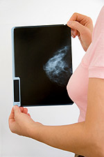 Η ψηφιακή μαστογραφία είναι μια νεότερη τεχνική που επιτρέπει καλύτερα την ανίχνευση του καρκίνου σε γυναίκες με μαστό αυξημένης πυκνότητας 
